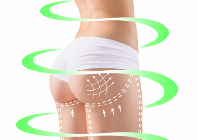 Lipofilling Corpo