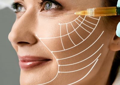 Lipofilling Viso