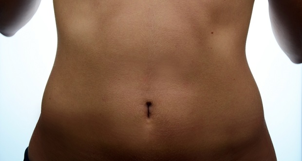 liposuzione bodytite Roma Nord