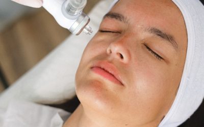 Trattamenti laser autunnali